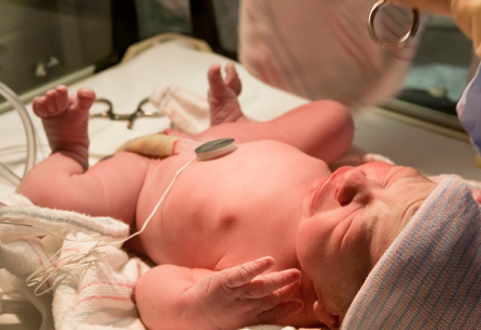 UCIN en Pachuca_sintomas