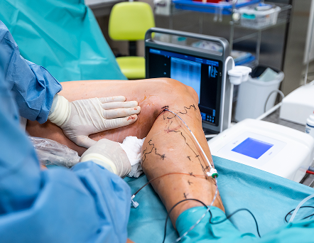 Cirugía Vascular Pachuca_motivos