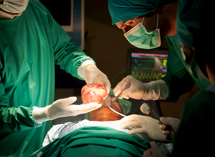 Trasplantes en Pachuca_situaciones