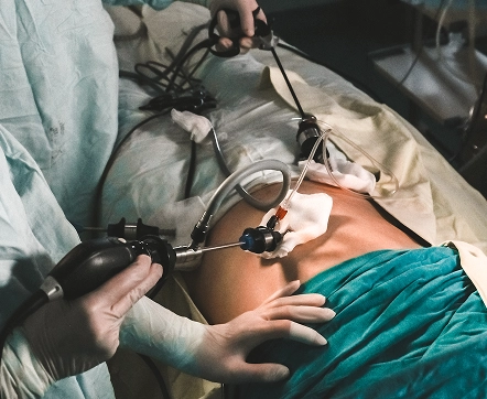 Cirugía Laparoscópica_procedimientos