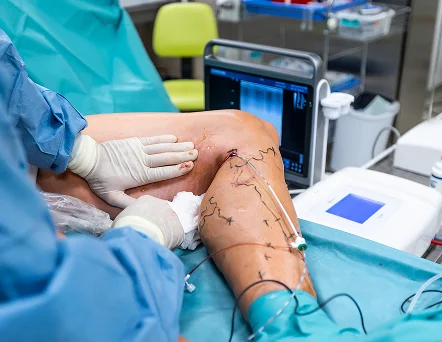 Cirugía Vascular Pachuca_motivos