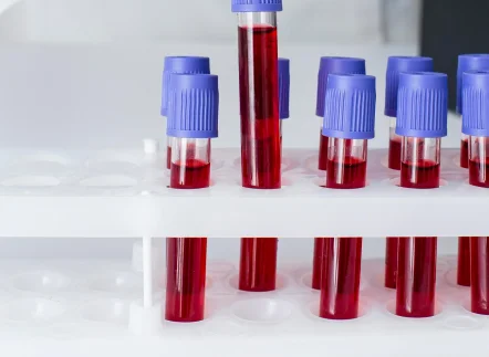 Laboratorio_pachuca_quien