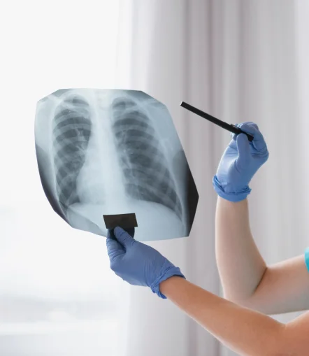 Radiologia_pachuca_beneficios