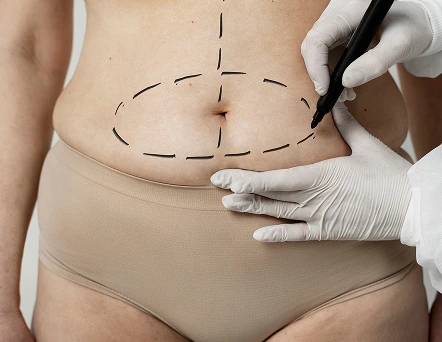 CirugiaPlastica_Pachuca_Procedimientos