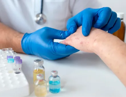 Dermatología_pachuca_sintomas