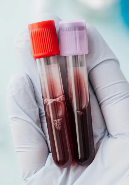 Hematología_pachuca_beneficios