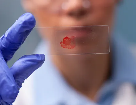 Hematología_pachuca_sintomas