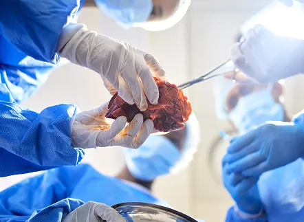 Trasplantes_sintomas