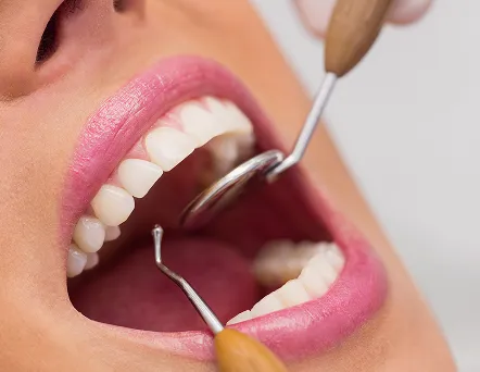 Odontología_pachuca_sintomas