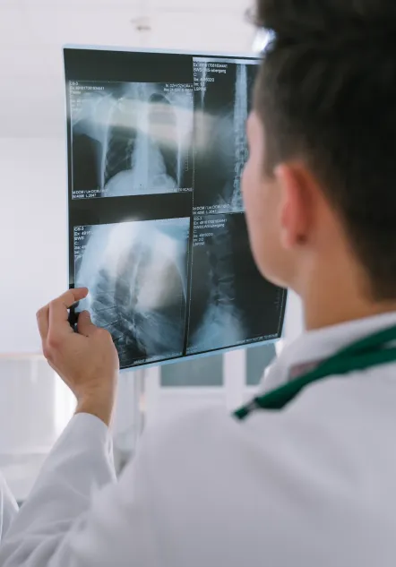 Radiooncologia_pachuca_beneficios